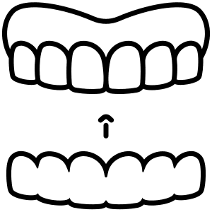 Mandibular Advancement Device