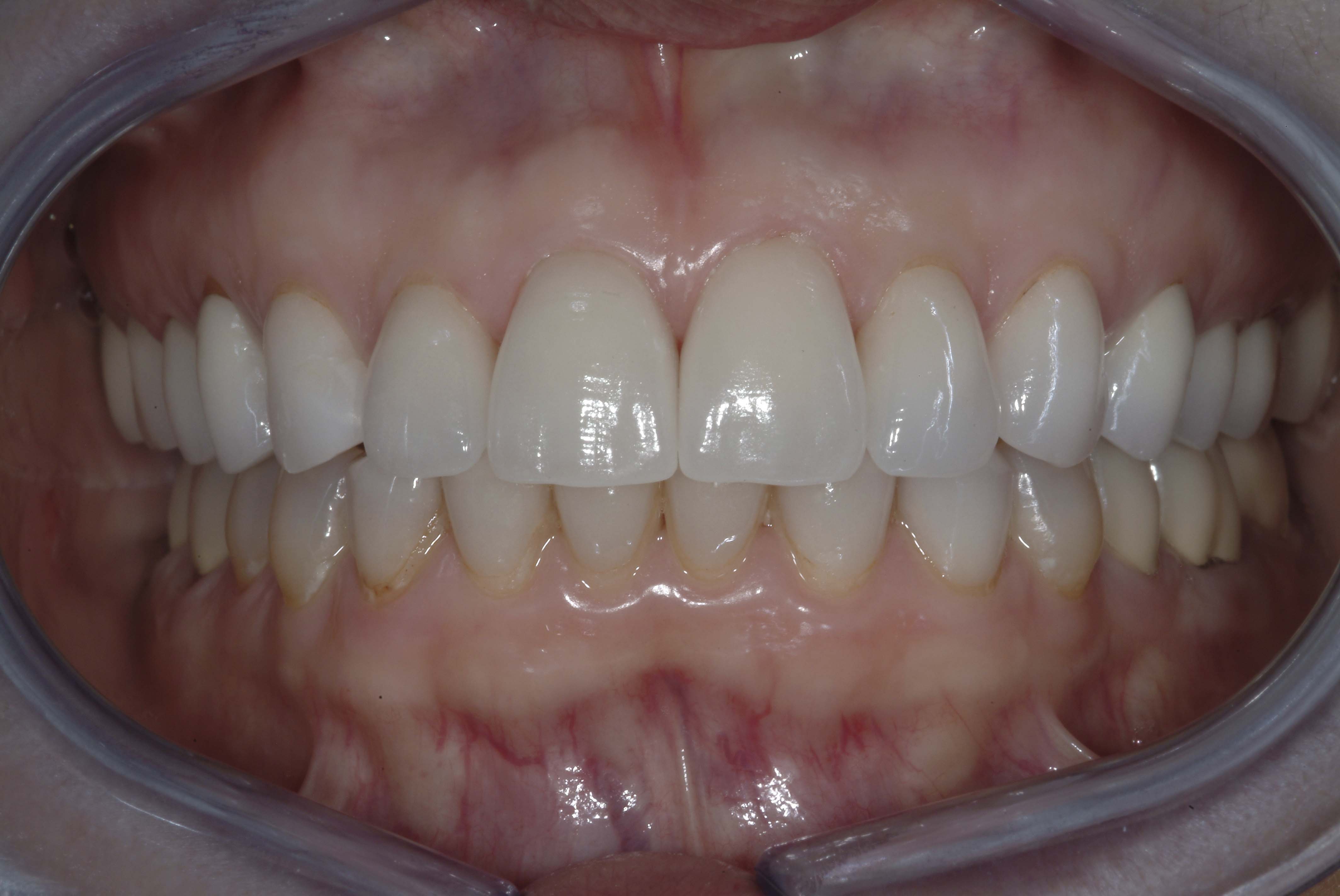 Aesthetic / Cosmetic Dentistry image